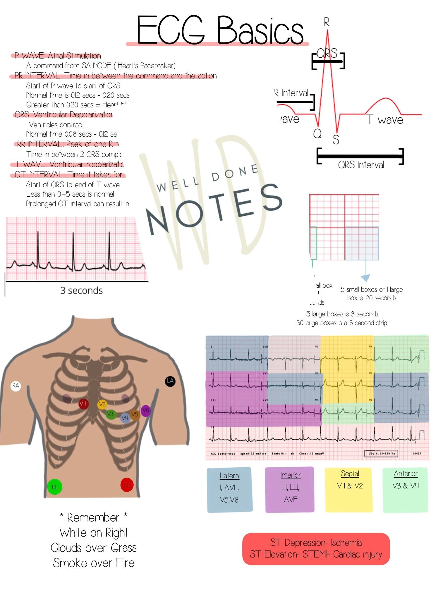 Free Printable Ekg Study Guide