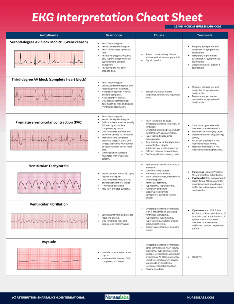 EKG Interpretation Cheat Sheet U0026 Heart Arrhythmias Guide 2020 Update 
