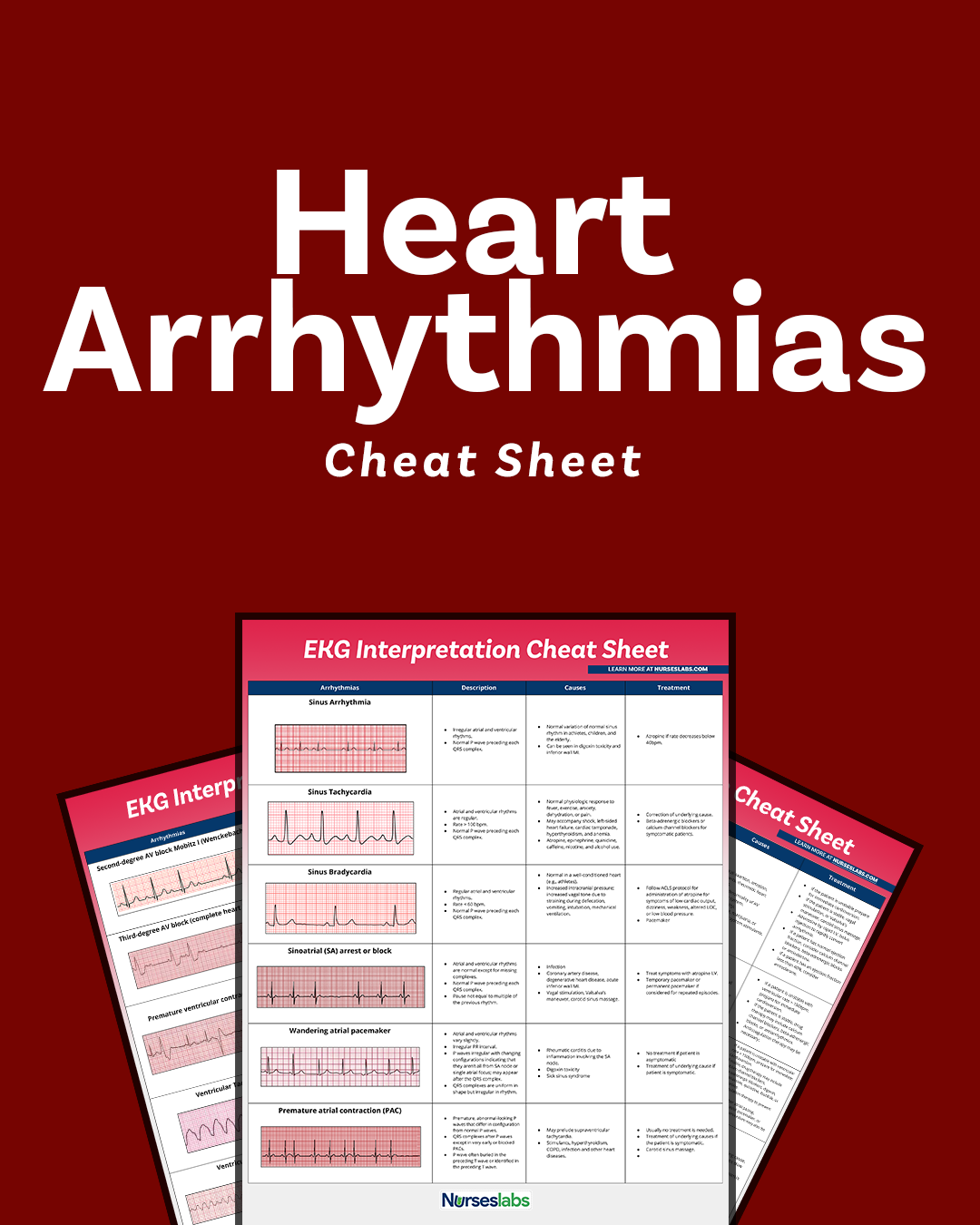 EKG Interpretation Cheat Sheet U0026 Heart Arrhythmias Guide 2020 Update 