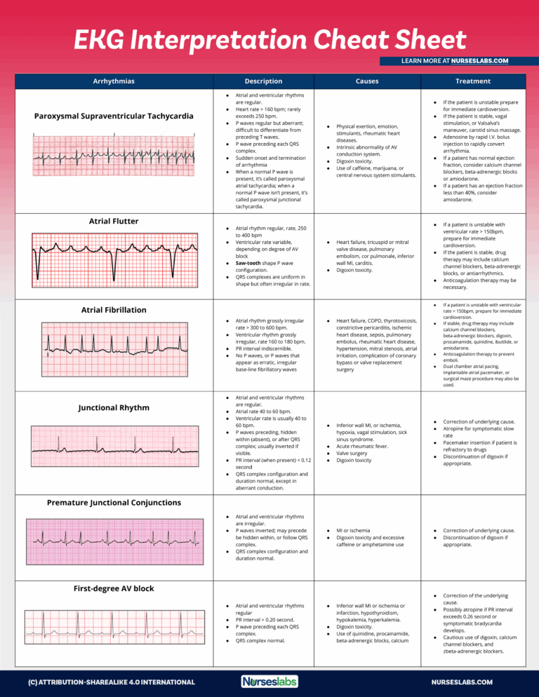 EKG Interpretation Cheat Sheet U0026 Heart Arrhythmias Guide 2020 Update 
